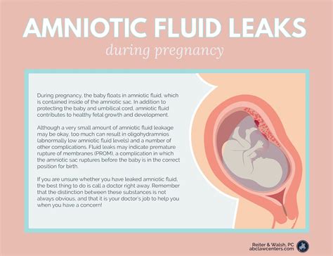 pregnant leaking fluid|Leaking Amniotic Fluid: How to Tell